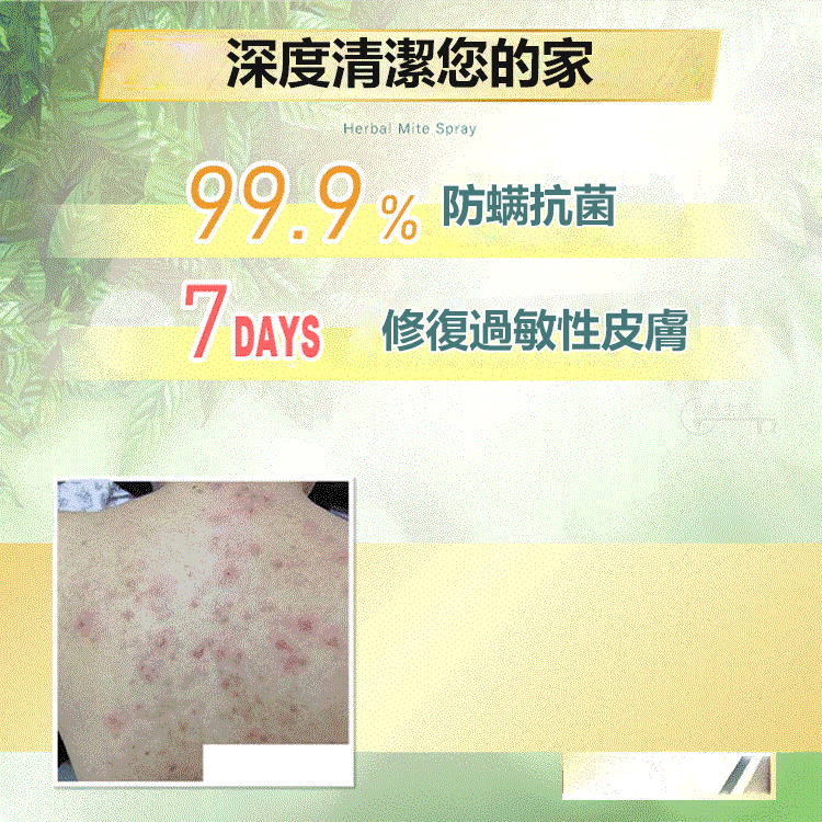 強效除蟎噴劑